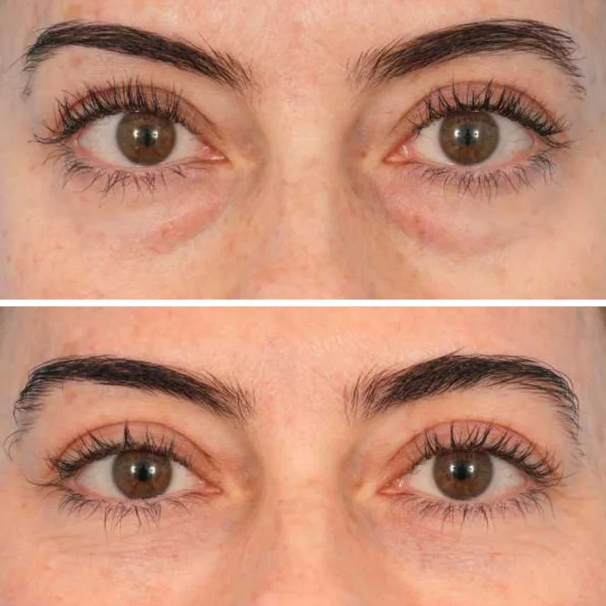 Collagen & Peptide Eye Patches