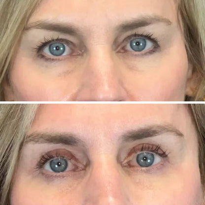 Collagen & Peptide Eye Patches