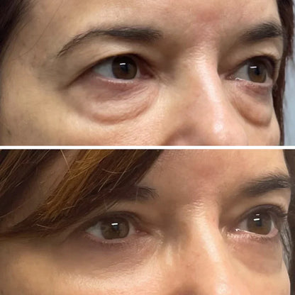 Collagen & Peptide Eye Patches