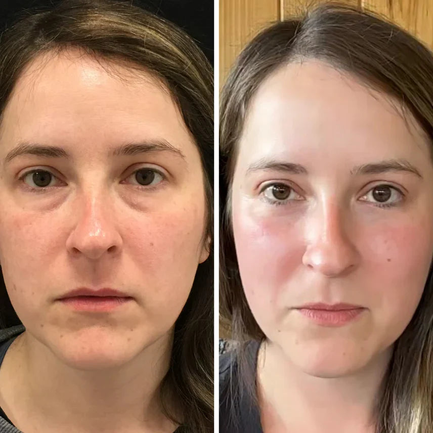 Collagen & Peptide Eye Patches