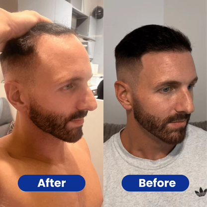 Capilène™ - Hair Growth Serum