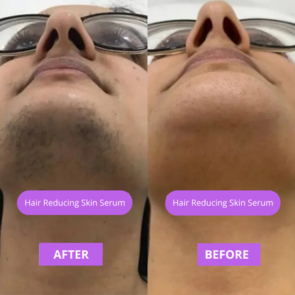 New Facial Hair Reducer Serum