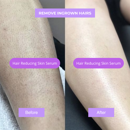 New Facial Hair Reducer Serum